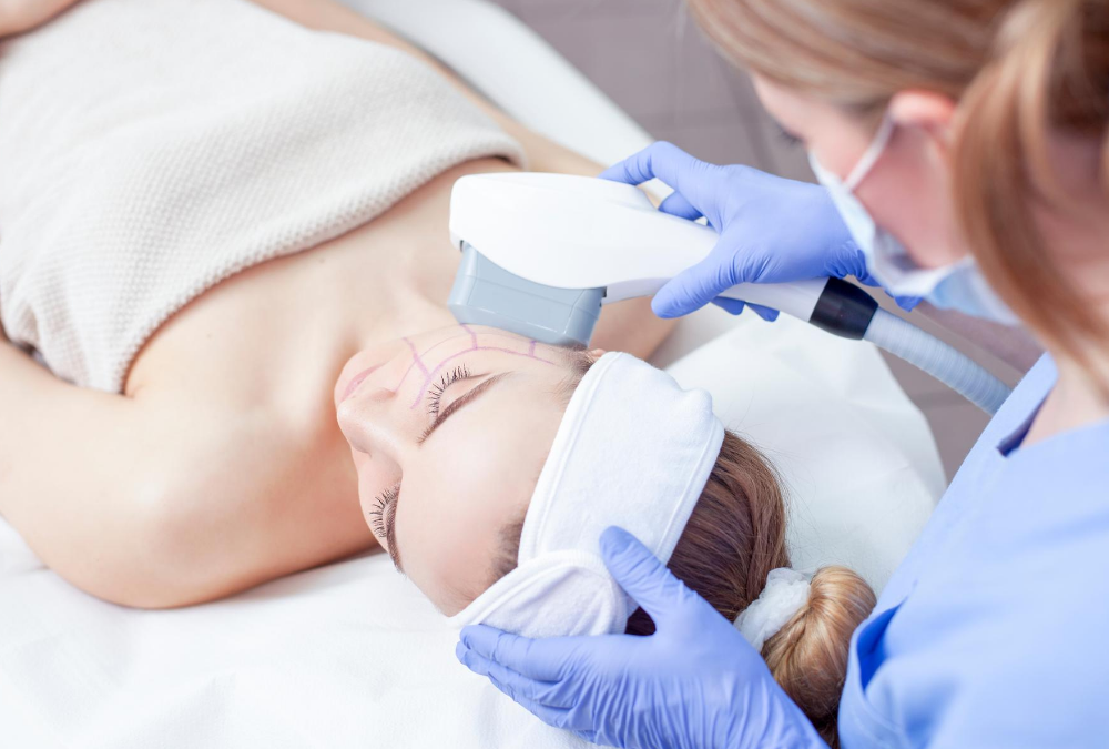 Laser Treatments in Reston: IPL for Acne