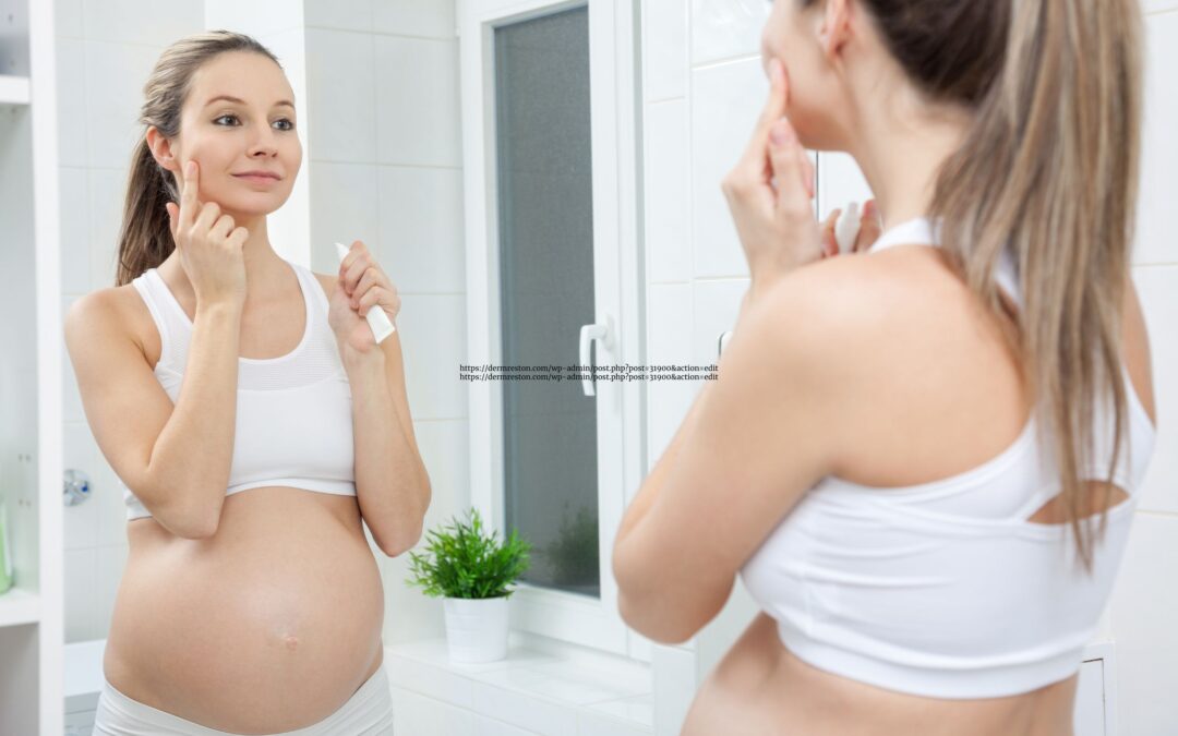 How Can I Find Pregnancy Safe Treatments For Acne