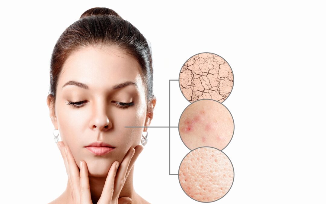 5 Reasons to See a Dermatologist