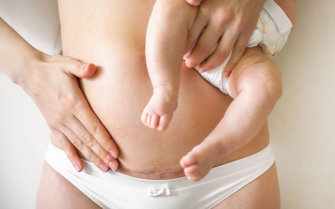 postpartum skin tightening reston va