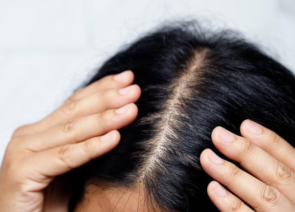 What Is Causing My Itchy Scalp?